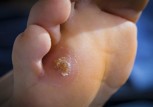 The Most Common Foot Problems and How to Treat Them