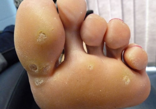 Expert Insights: The Most Common Foot Problems and How to Treat Them