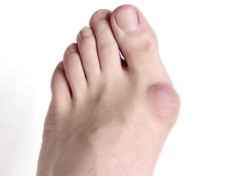 Expert Insights: Understanding Foot Pain and Its Causes