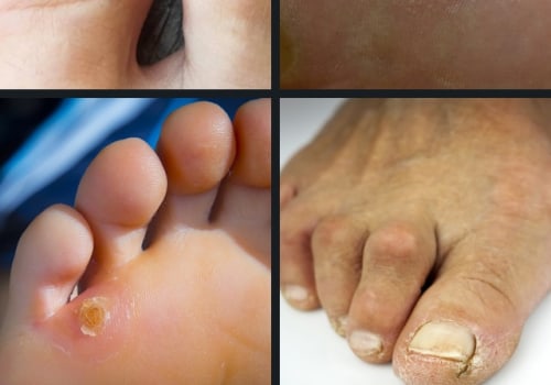 Expert Tips for Keeping Your Feet Healthy and Happy